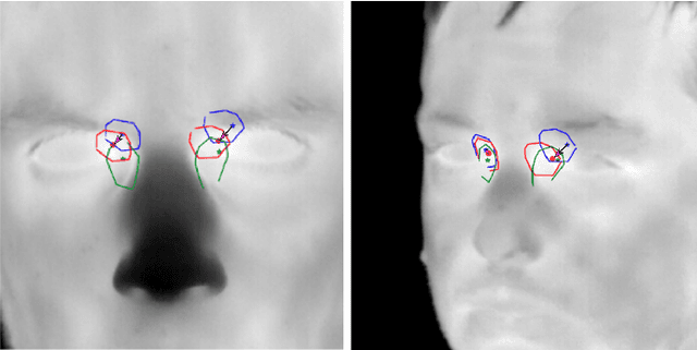 Figure 3 for Inner Eye Canthus Localization for Human Body Temperature Screening