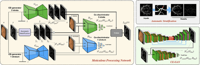 Figure 1 for A Two-Stream Meticulous Processing Network for Retinal Vessel Segmentation