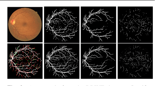 Figure 3 for A Two-Stream Meticulous Processing Network for Retinal Vessel Segmentation