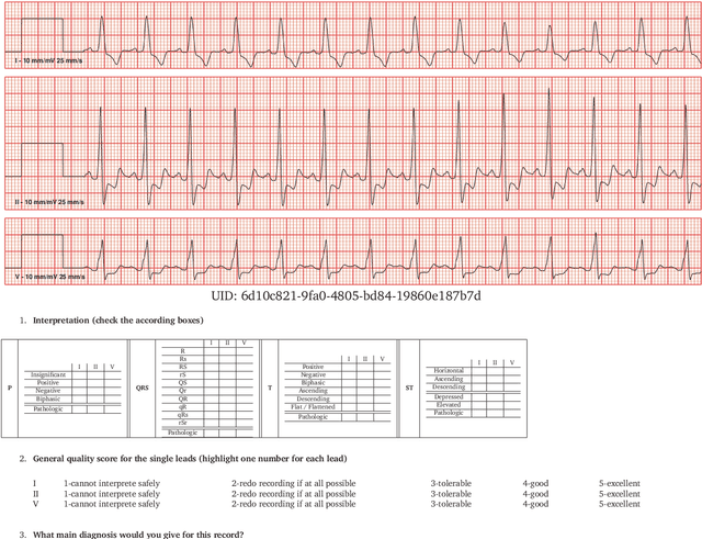 Figure 3 for Diagnostic Quality Assessment for Low-Dimensional ECG Representations