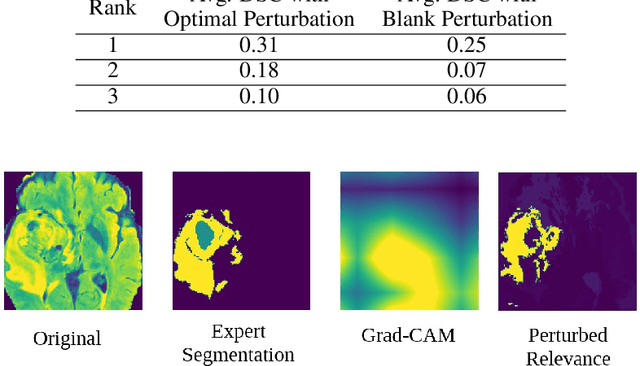 Figure 2 for Localized Perturbations For Weakly-Supervised Segmentation of Glioma Brain Tumours