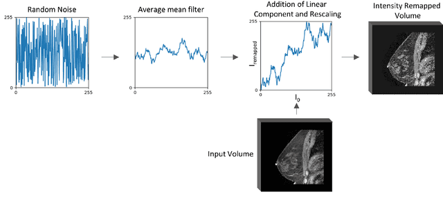 Figure 3 for Intensity augmentation for domain transfer of whole breast segmentation in MRI
