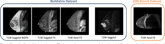 Figure 4 for Intensity augmentation for domain transfer of whole breast segmentation in MRI