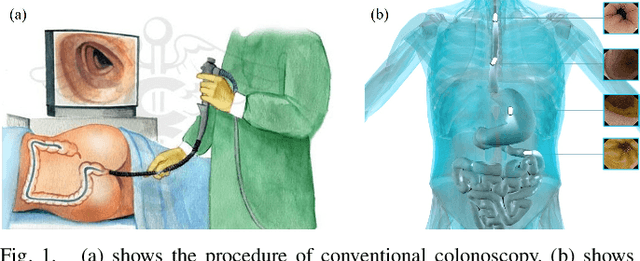 Figure 1 for Autonomous Magnetic Navigation Framework for Active Wireless Capsule Endoscopy Inspired by Conventional Colonoscopy Procedures