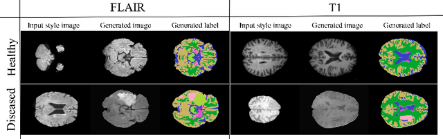Figure 3 for Can segmentation models be trained with fully synthetically generated data?