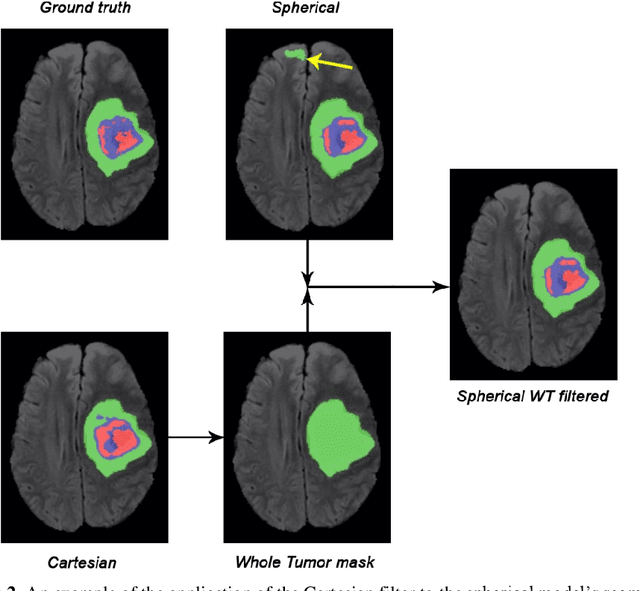 Figure 3 for Impact of Spherical Coordinates Transformation Pre-processing in Deep Convolution Neural Networks for Brain Tumor Segmentation and Survival Prediction