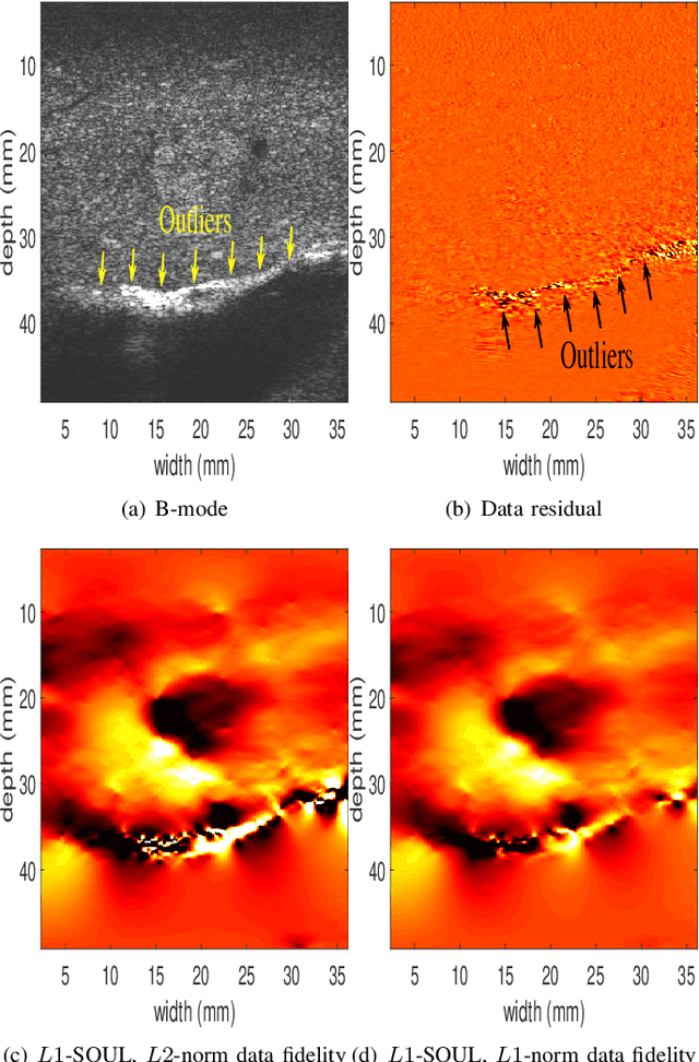 Figure 3 for Second-Order Ultrasound Elastography with L1-norm Spatial Regularization