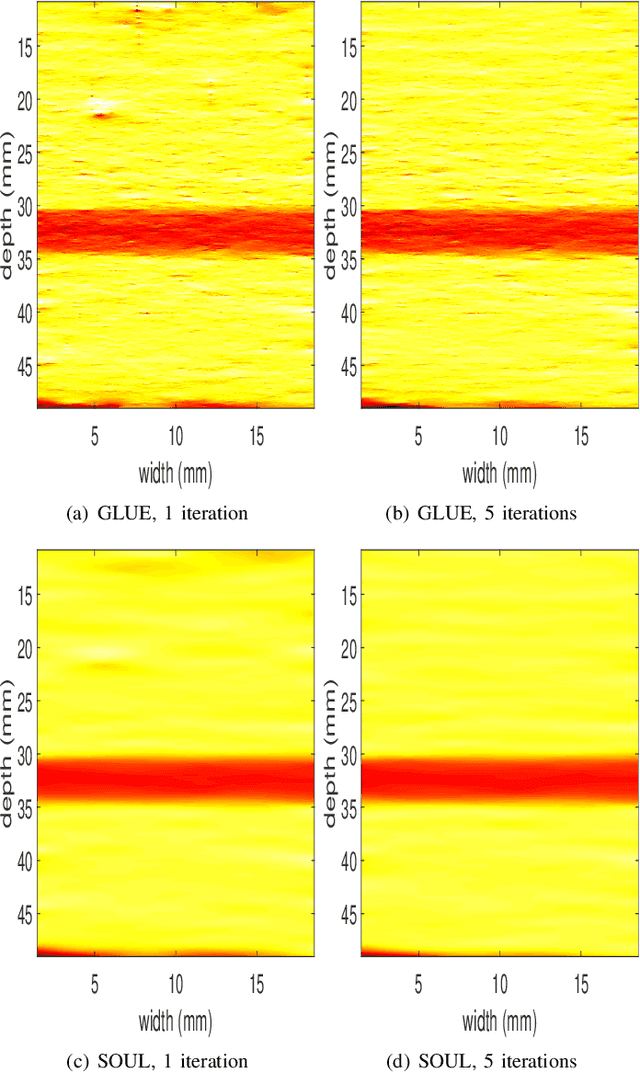 Figure 4 for Second-Order Ultrasound Elastography with L1-norm Spatial Regularization