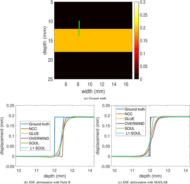 Figure 2 for Second-Order Ultrasound Elastography with L1-norm Spatial Regularization