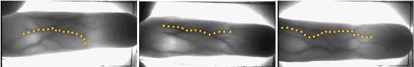 Figure 2 for A Local Descriptor with Physiological Characteristic for Finger Vein Recognition