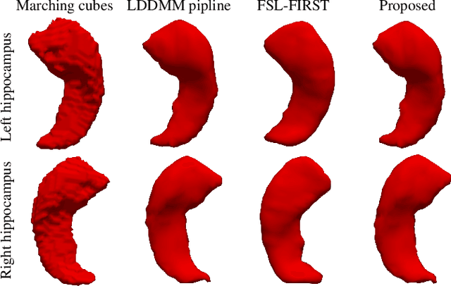 Figure 3 for Automatic hippocampal surface generation via 3D U-net and active shape modeling with hybrid particle swarm optimization