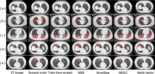 Figure 2 for Does Non-COVID19 Lung Lesion Help? Investigating Transferability in COVID-19 CT Image Segmentation