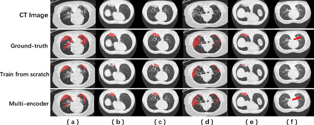 Figure 3 for Does Non-COVID19 Lung Lesion Help? Investigating Transferability in COVID-19 CT Image Segmentation