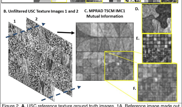 Figure 4 for MPRAD: A Multiparametric Radiomics Framework