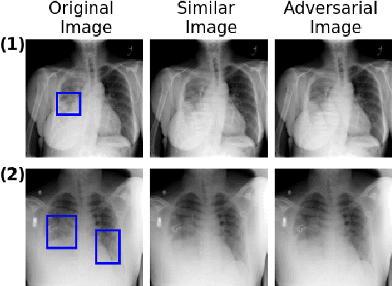 Figure 2 for Combining Similarity and Adversarial Learning to Generate Visual Explanation: Application to Medical Image Classification