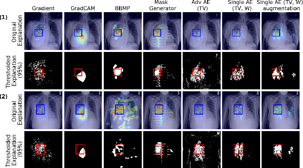 Figure 3 for Combining Similarity and Adversarial Learning to Generate Visual Explanation: Application to Medical Image Classification