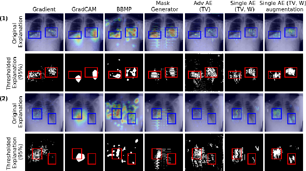 Figure 4 for Combining Similarity and Adversarial Learning to Generate Visual Explanation: Application to Medical Image Classification