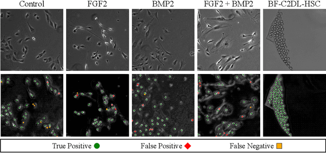 Figure 3 for Cell Detection from Imperfect Annotation by Pseudo Label Selection Using P-classification