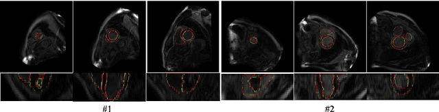 Figure 4 for An Automatic Cardiac Segmentation Framework based on Multi-sequence MR Image