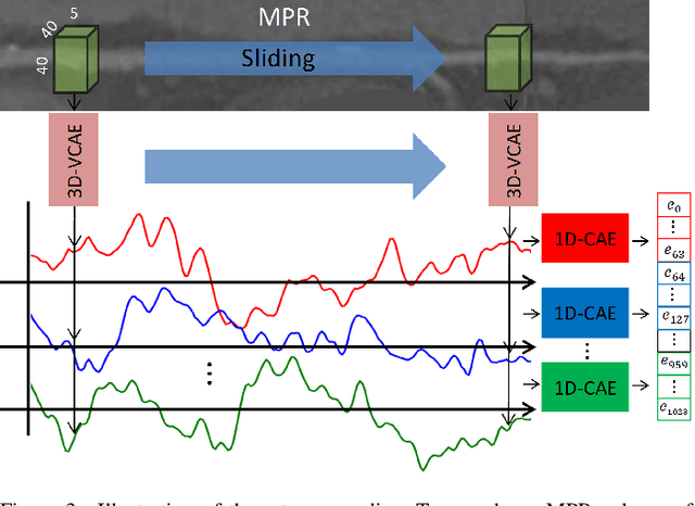 Figure 2 for Combined analysis of coronary arteries and the left ventricular myocardium in cardiac CT angiography for detection of patients with functionally significant stenosis