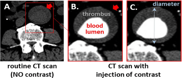 Figure 1 for A Deep Learning Approach to Automate High-Resolution Blood Vessel Reconstruction on Computerized Tomography Images With or Without the Use of Contrast Agent