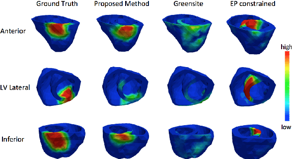 Figure 4 for Generative Modeling and Inverse Imaging of Cardiac Transmembrane Potential