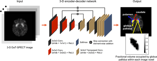 Figure 1 for Fully automated 3D segmentation of dopamine transporter SPECT images using an estimation-based approach