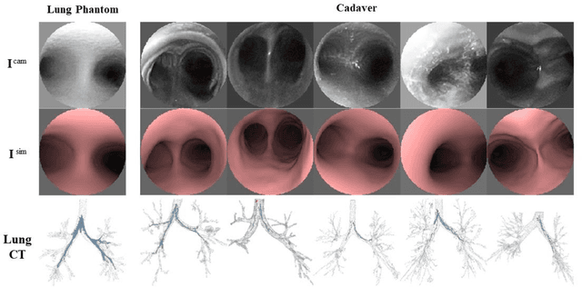 Figure 3 for Deep Learning for Localization in the Lung
