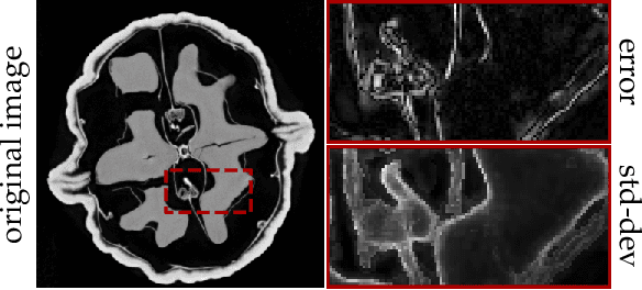 Figure 1 for A Probabilistic Deep Image Prior for Computational Tomography