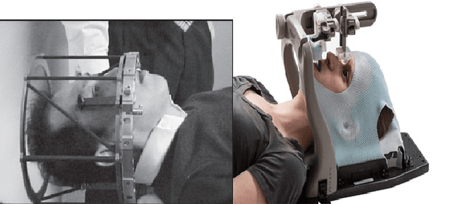 Figure 1 for Mechanism and Model of a Soft Robot for Head Stabilization in Cancer Radiation Therapy