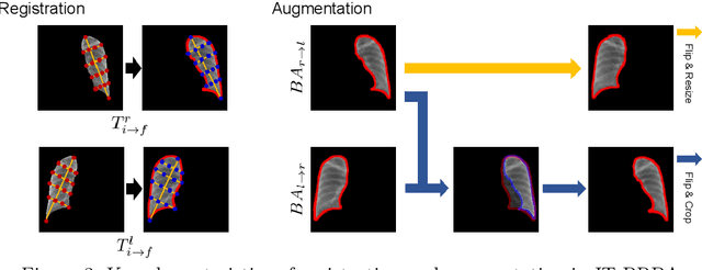 Figure 4 for Improved Generative Model for Weakly Supervised Chest Anomaly Localization via Pseudo-paired Registration with Bilaterally Symmetrical Data Augmentation