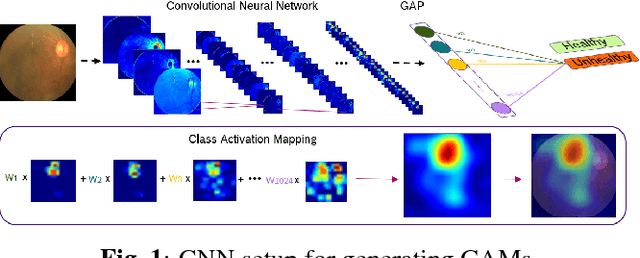 Figure 1 for Weakly-supervised localization of diabetic retinopathy lesions in retinal fundus images