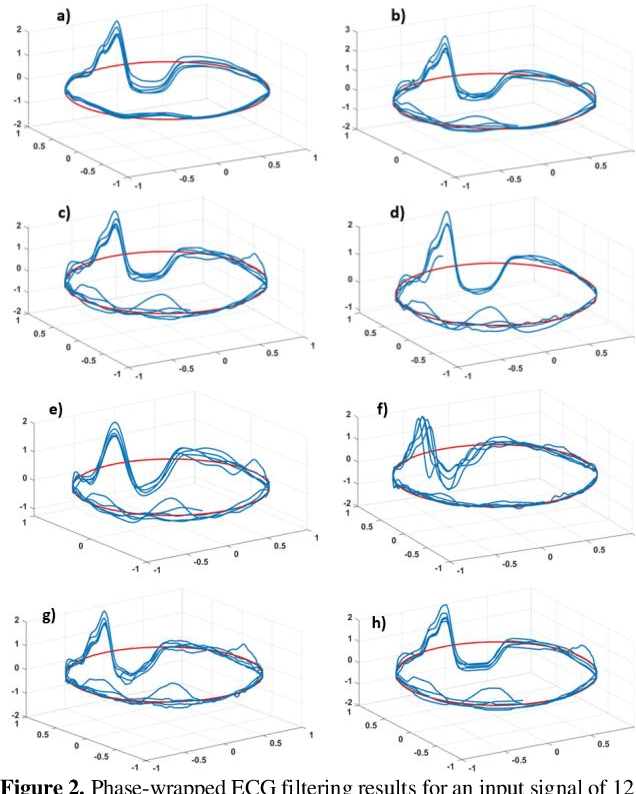 Figure 3 for A Novel ECG Denoising Scheme Using the Ensemble Kalman Filter