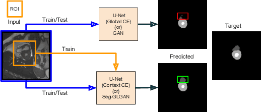 Figure 1 for A context based deep learning approach for unbalanced medical image segmentation