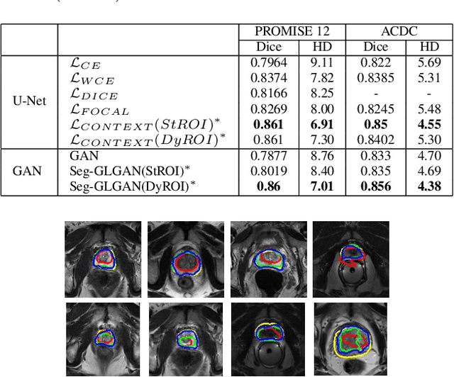 Figure 2 for A context based deep learning approach for unbalanced medical image segmentation