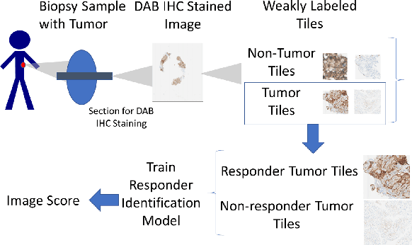 Figure 1 for Deep Learning Derived Histopathology Image Score for Increasing Phase 3 Clinical Trial Probability of Success