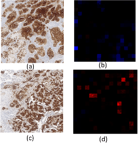 Figure 4 for Deep Learning Derived Histopathology Image Score for Increasing Phase 3 Clinical Trial Probability of Success