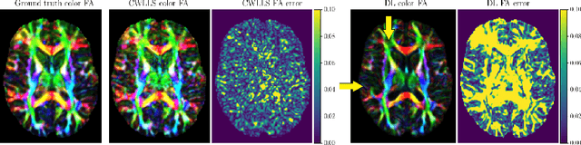 Figure 2 for Calibrated Diffusion Tensor Estimation