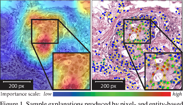 Figure 1 for Quantifying Explainers of Graph Neural Networks in Computational Pathology