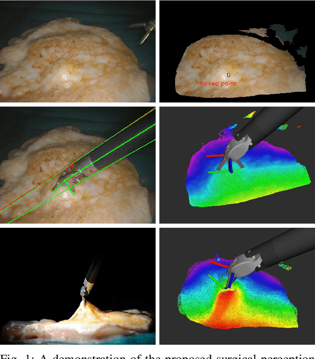 Figure 1 for SuPer: A Surgical Perception Framework for Endoscopic Tissue Manipulation with Surgical Robotics