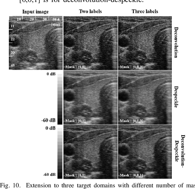 Figure 2 for OT-driven Multi-Domain Unsupervised Ultrasound Image Artifact Removal using a Single CNN