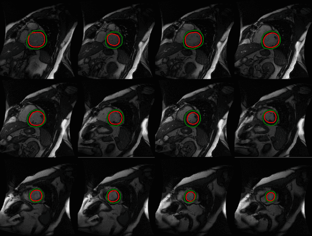 Figure 4 for A Fully Convolutional Neural Network for Cardiac Segmentation in Short-Axis MRI
