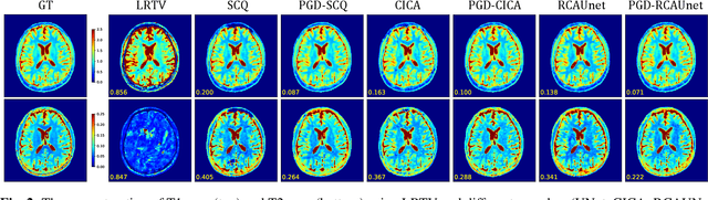 Figure 3 for Deep Unrolling for Magnetic Resonance Fingerprinting