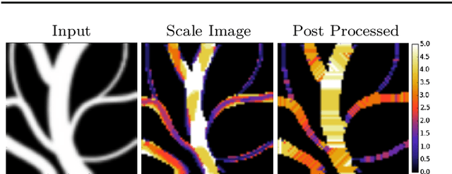 Figure 4 for Multi-Scale Anisotropic Fourth-Order Diffusion Improves Ridge and Valley Localization