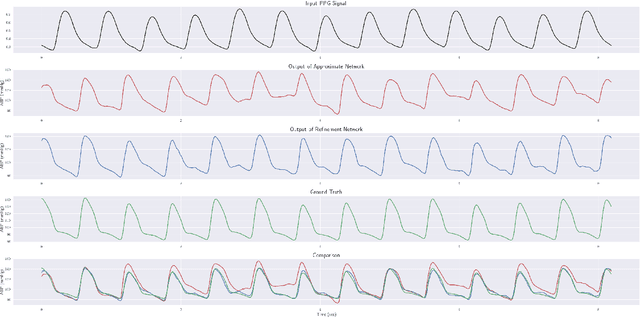 Figure 3 for PPG2ABP: Translating Photoplethysmogram (PPG) Signals to Arterial Blood Pressure (ABP) Waveforms using Fully Convolutional Neural Networks