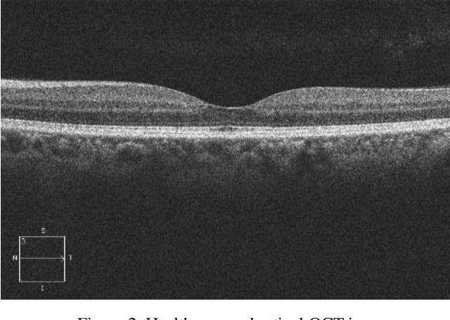 Figure 2 for OCTID: Optical Coherence Tomography Image Database