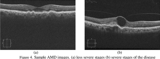 Figure 4 for OCTID: Optical Coherence Tomography Image Database