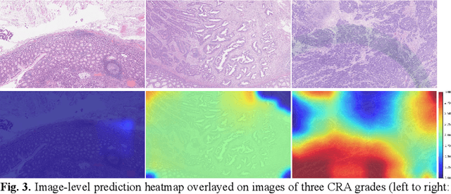 Figure 3 for Cells are Actors: Social Network Analysis with Classical ML for SOTA Histology Image Classification