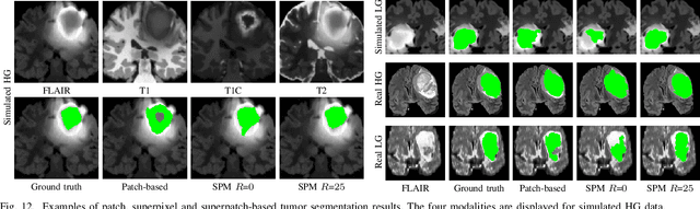 Figure 4 for SuperPatchMatch: an Algorithm for Robust Correspondences using Superpixel Patches