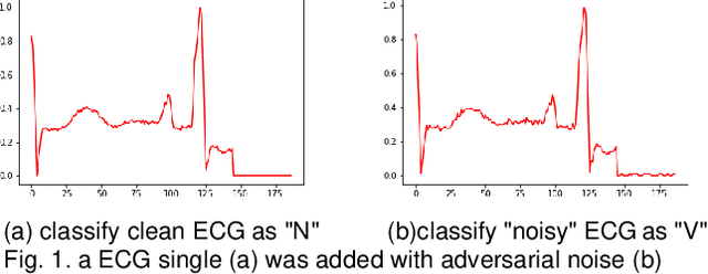 Figure 1 for A Regularization Method to Improve Adversarial Robustness of Neural Networks for ECG Signal Classification